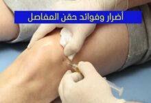 أهم 10 فوائد لحقن المفاصل وطريقة العلاج وانواع الحقن