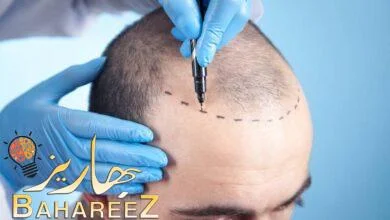 مركز زراعة الشعر التركي (Hair of Istanbul) حالياً في دبي