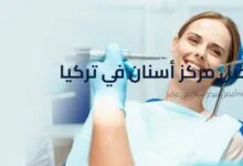 أفضل مركز أسنان في تركيا