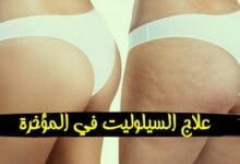طرق علاج السيلوليت في المؤخرة واهم اسبابها طرق علاج السيلوليت في المؤخرة واهم اسبابها