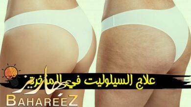 طرق علاج السيلوليت في المؤخرة واهم اسبابها طرق علاج السيلوليت في المؤخرة واهم اسبابها